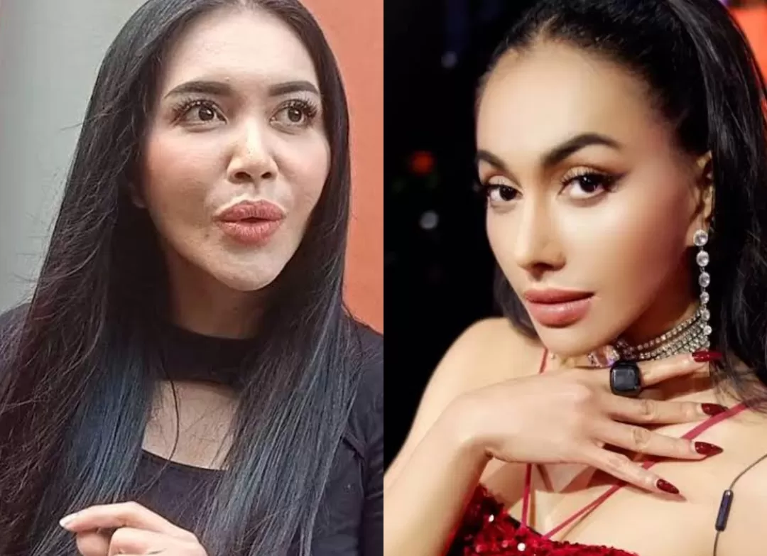 Denada Jadi Sorotan: Penampilan Baru dan Keberanian Pasca Operasi Plastik